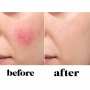Ben Nye Red Neutralizer